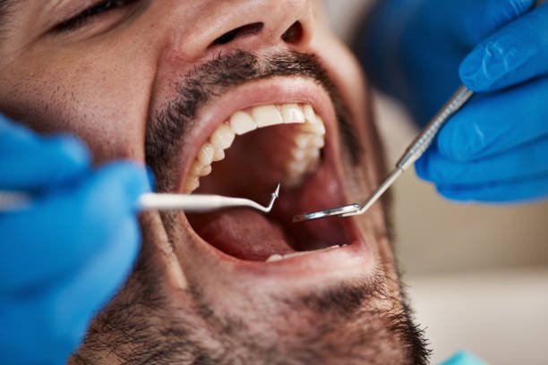 Best Emergency Treatment for Jaw Pain or Injury in Brandon, MS